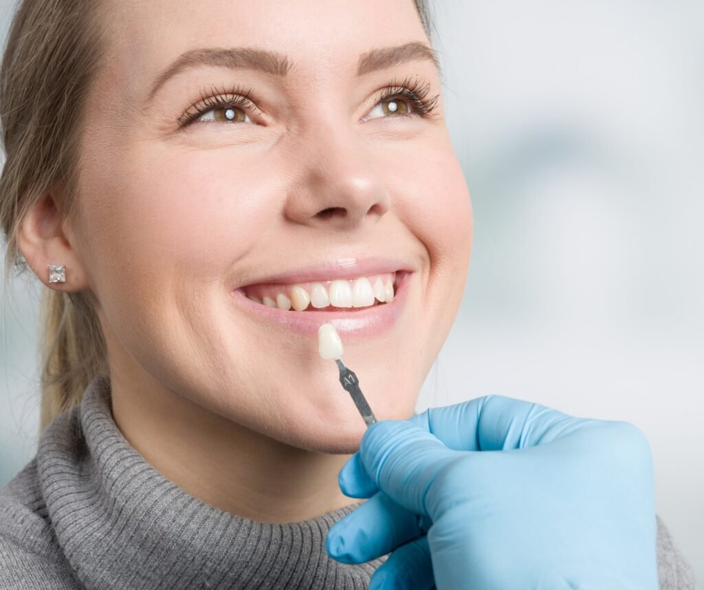 Close-up of dental veneers enhancing a patient’s bright and perfect smile.